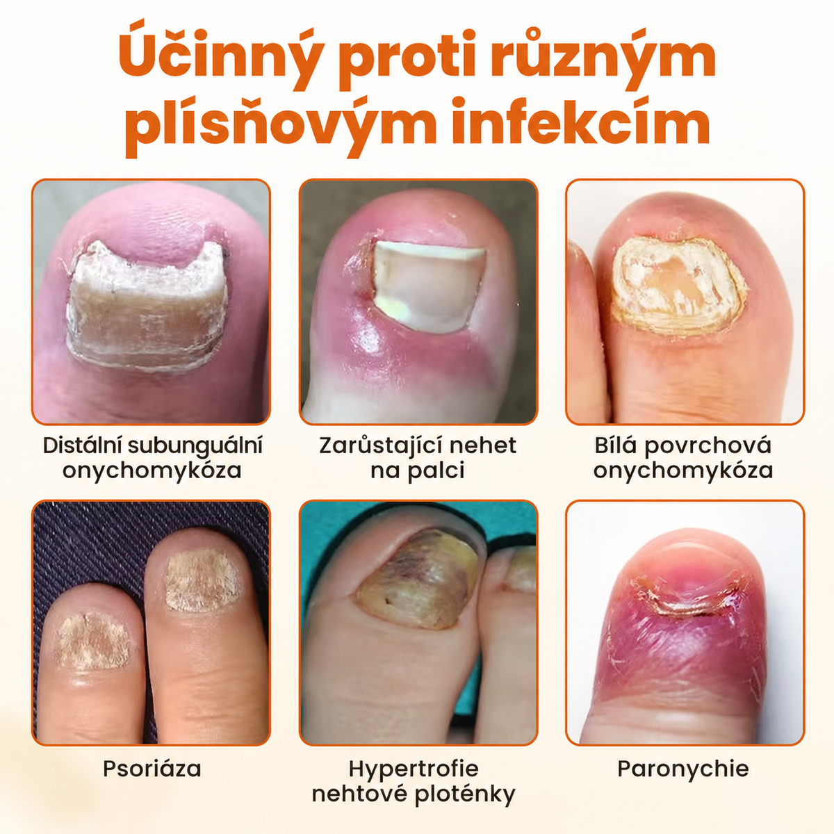 Timilk® FungiBee Advanced – Regenerační sprej pro oslabené nehty📦