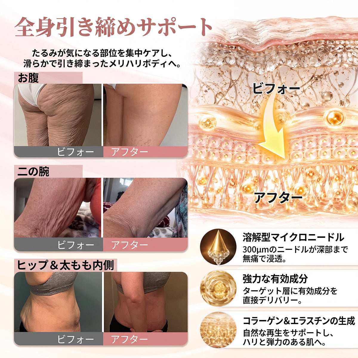HISKIN® 🎁 🎁 初回購入者限定特典！追加購入で50％OFFをご利用いただけます✨ 1️⃣ ナノ強化美容フォーミュラ —コラーゲン・ペプチド・ヒアルロン酸配合で、ふっくらとした印象とハリのある美しいラインをサポート🛡️