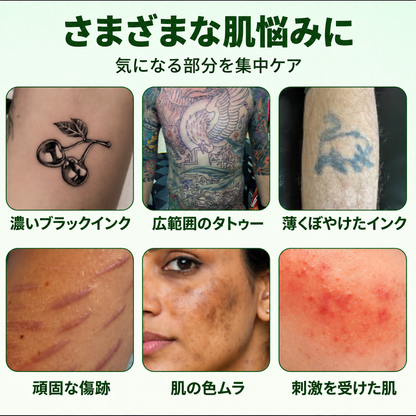 Micdtry® PureAlgae タトゥー除去サポートスプレーB - 古いタトゥーの色素にさよなら、頑固なインクを薄くし、施術後の肌を修復・滑らかに - レーザー不要、今すぐお試しください！✨