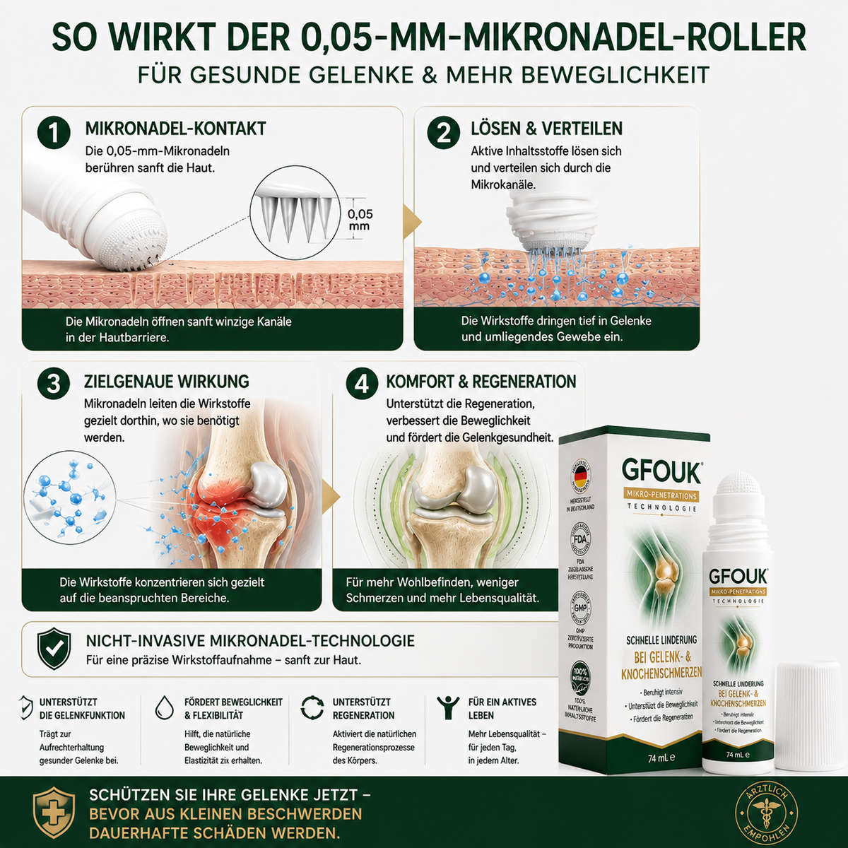 GFOUK® 0,05 mm-es mikrotűs görgő ízület- és csontápoláshoz – 6. termékkép