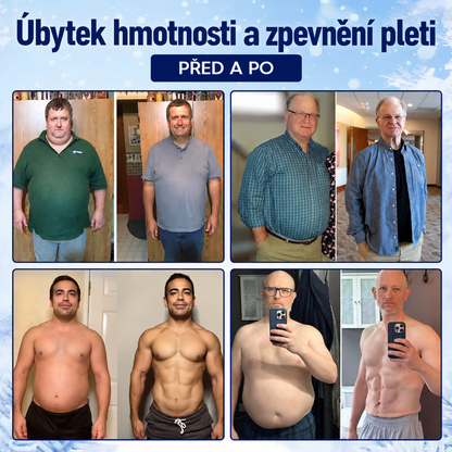 Mirevane CryoContour 4 v 1 – mlha pro tvarování postavy