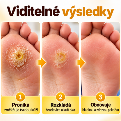 Roltine® BeeClear – regenerační krém na bradavice a kuří oka