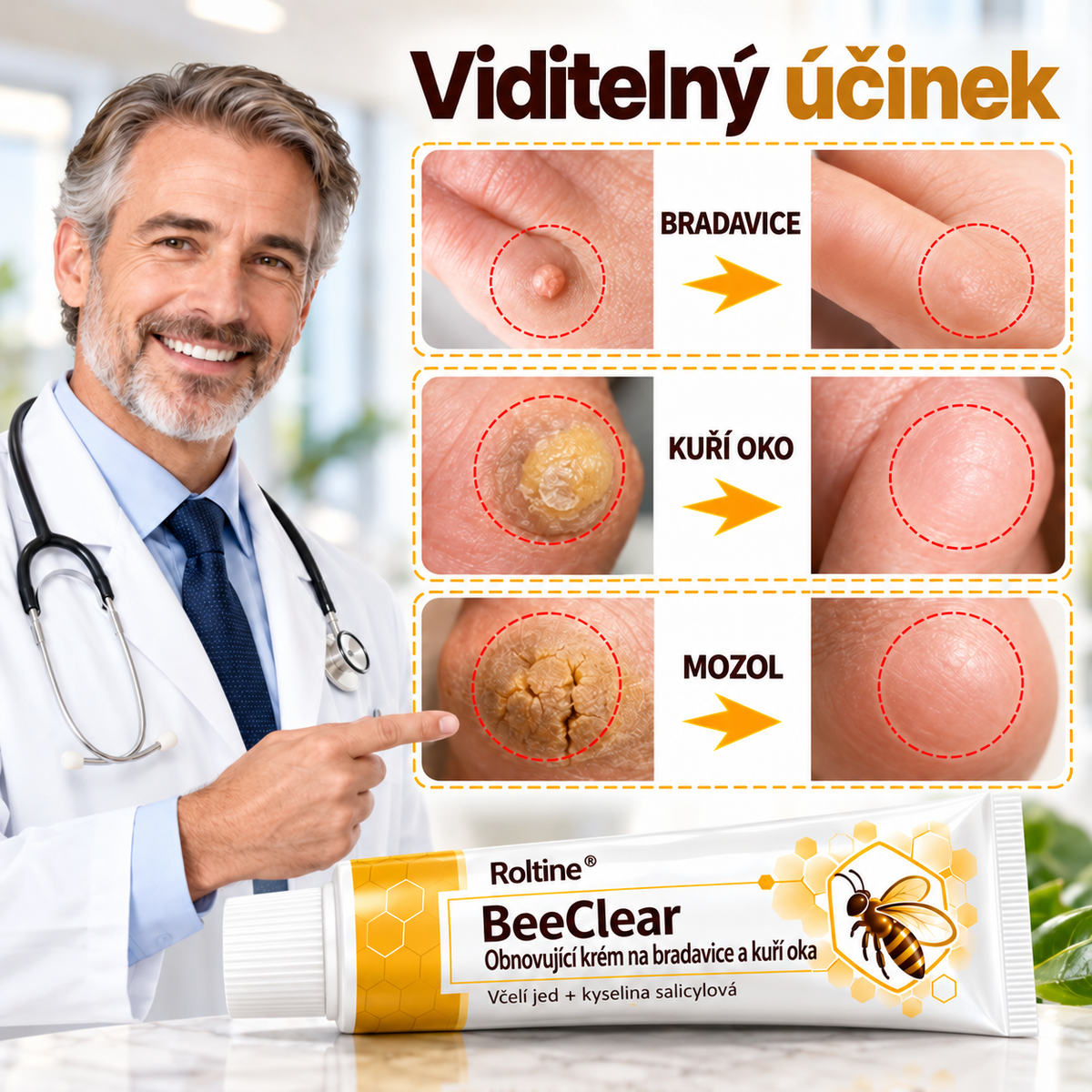 Roltine® BeeClear – regenerační krém na bradavice a kuří oka