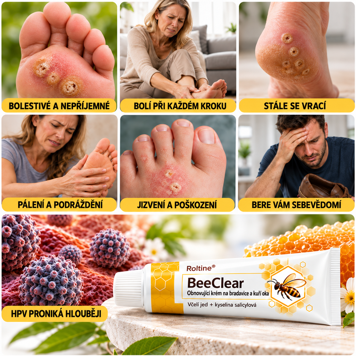 Roltine® BeeClear – regenerační krém na bradavice a kuří oka