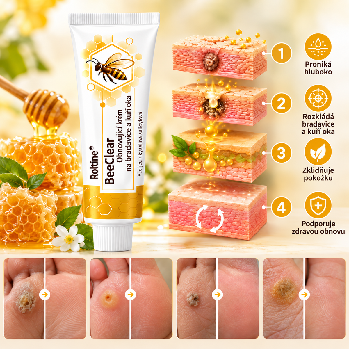 Roltine® BeeClear – regenerační krém na bradavice a kuří oka