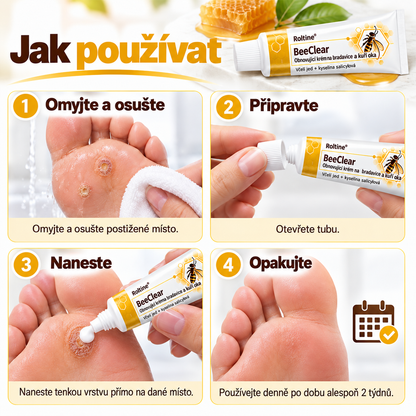 Roltine® BeeClear – regenerační krém na bradavice a kuří oka